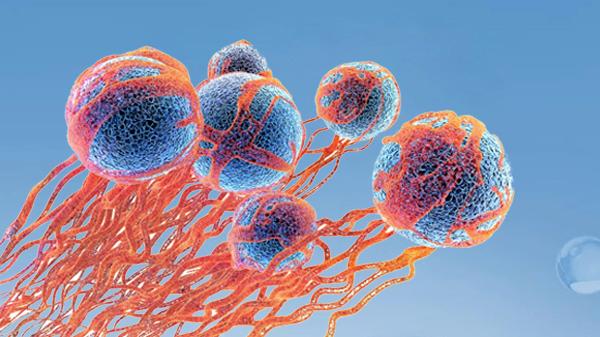 抗癌18年從未復發，她總結的7個重點，值得癌症患者學習、收藏！